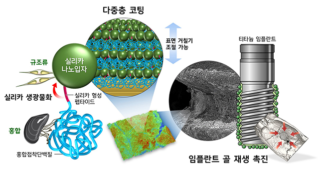 포스텍 연구팀이 임플란트 표면을 코팅하고 잇몸뼈에 빠르게 안착할 수 있도록 회복을 돕는 기술을 개발했다.