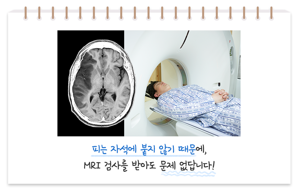 피는 자석에 붙지 않기 때문에, MRI 검사를 받아도 문제 없답니다! 사진은 MRI 검사를 진행하는 사람과 MRI 검사 결과의 이미지